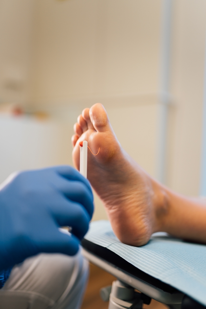 Care for Diabetic Foot Ulcer