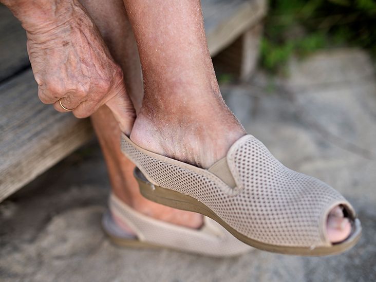 Daily Foot Care Routine for Diabetics