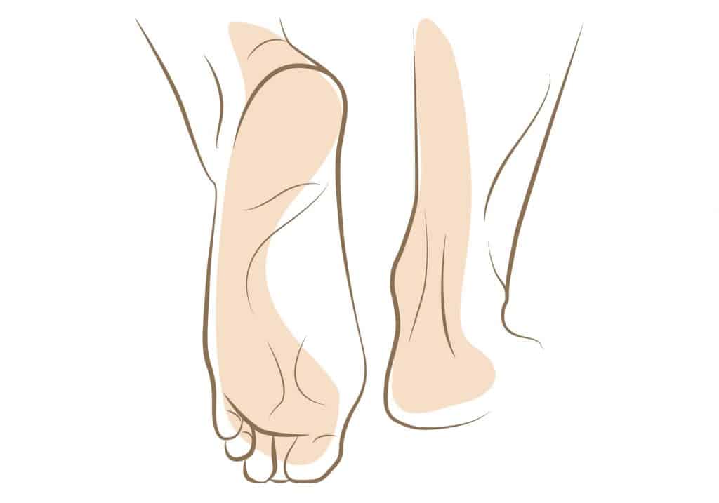 Embracing Care Navigating the Challenges of Diabetes and Dry Feet