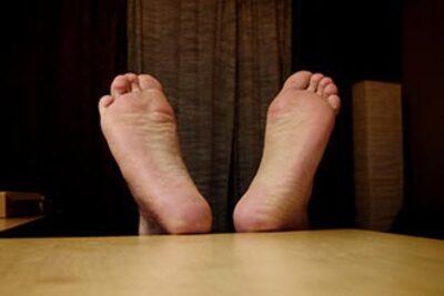Understanding Dry Feet Diabetes